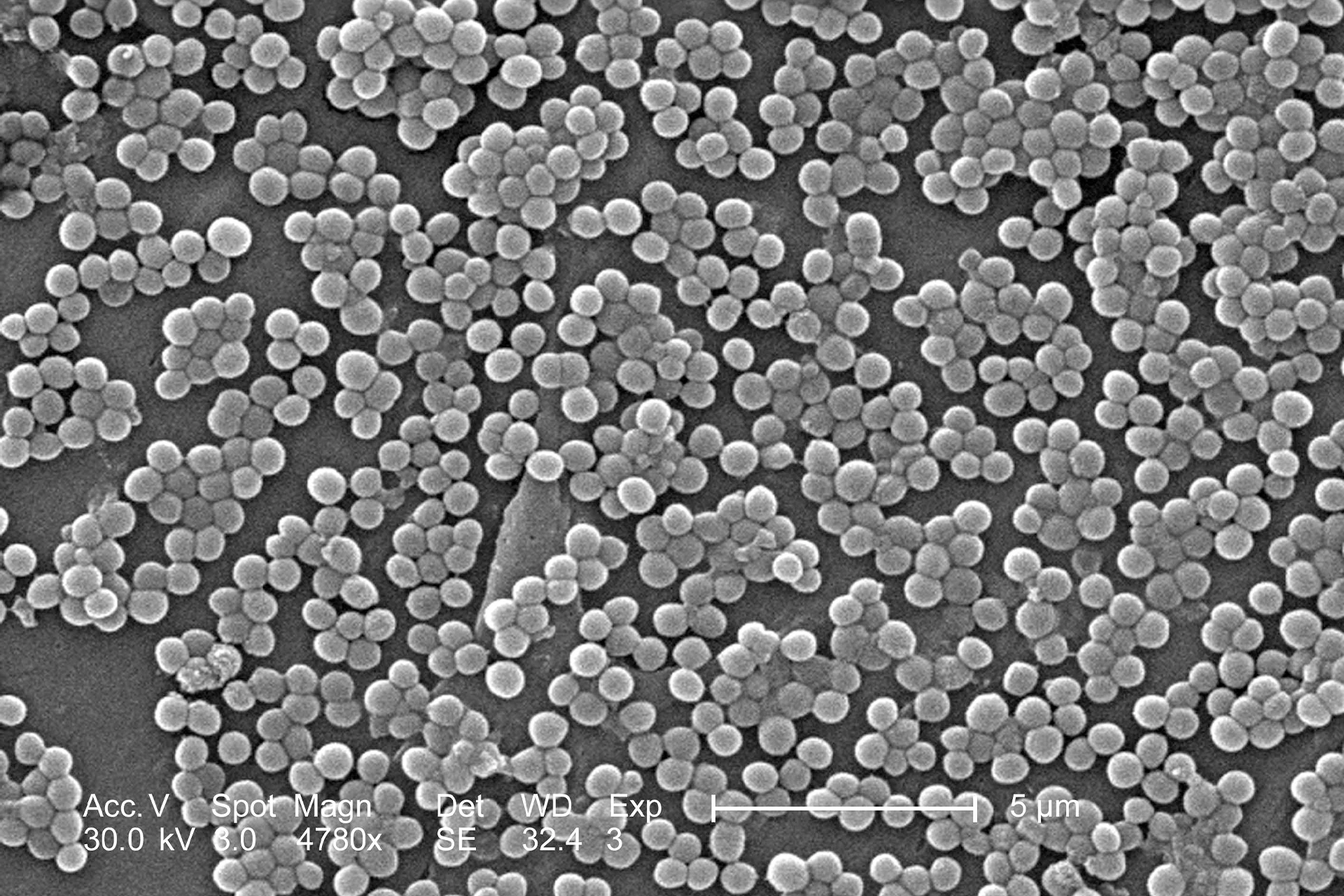 Electron micrograph of many round bacteria cells