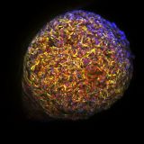 Caught! The cell behind a lung cancer | Pursuit by the University of ...