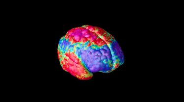 Mapping how schizophrenia changes brains thumbnail image