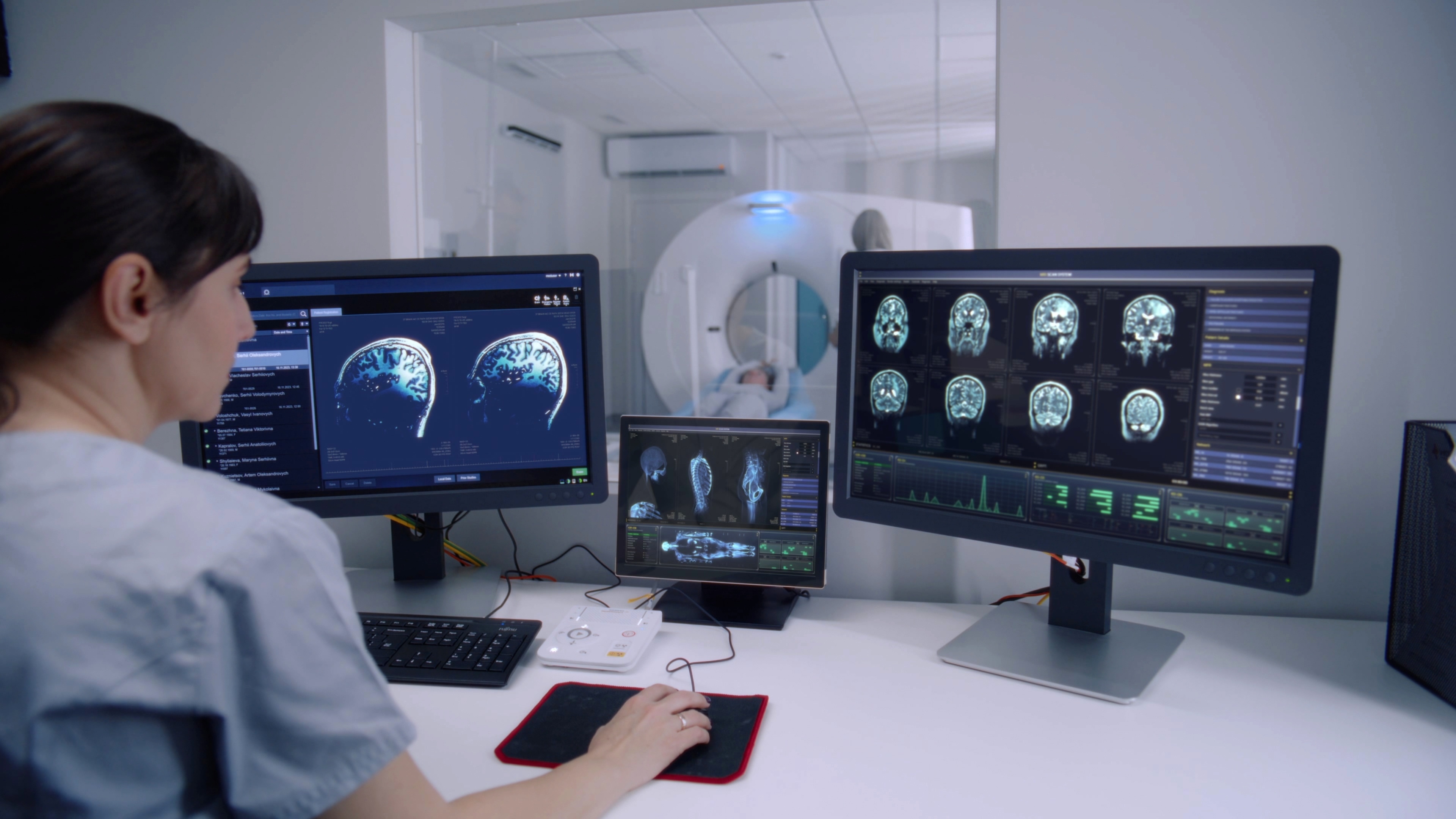 CT scanning of the brain