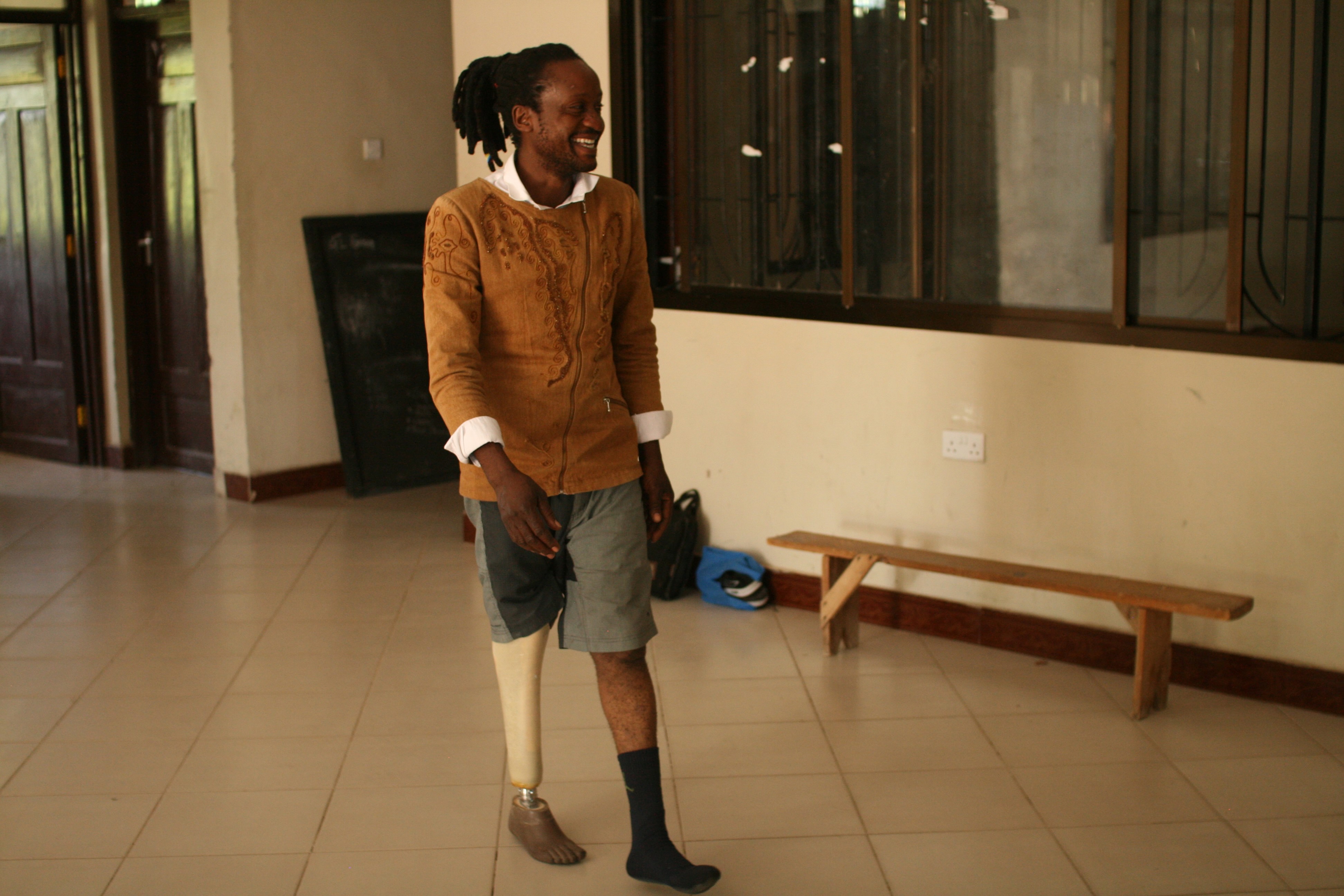 Patient tries on new prosthetic