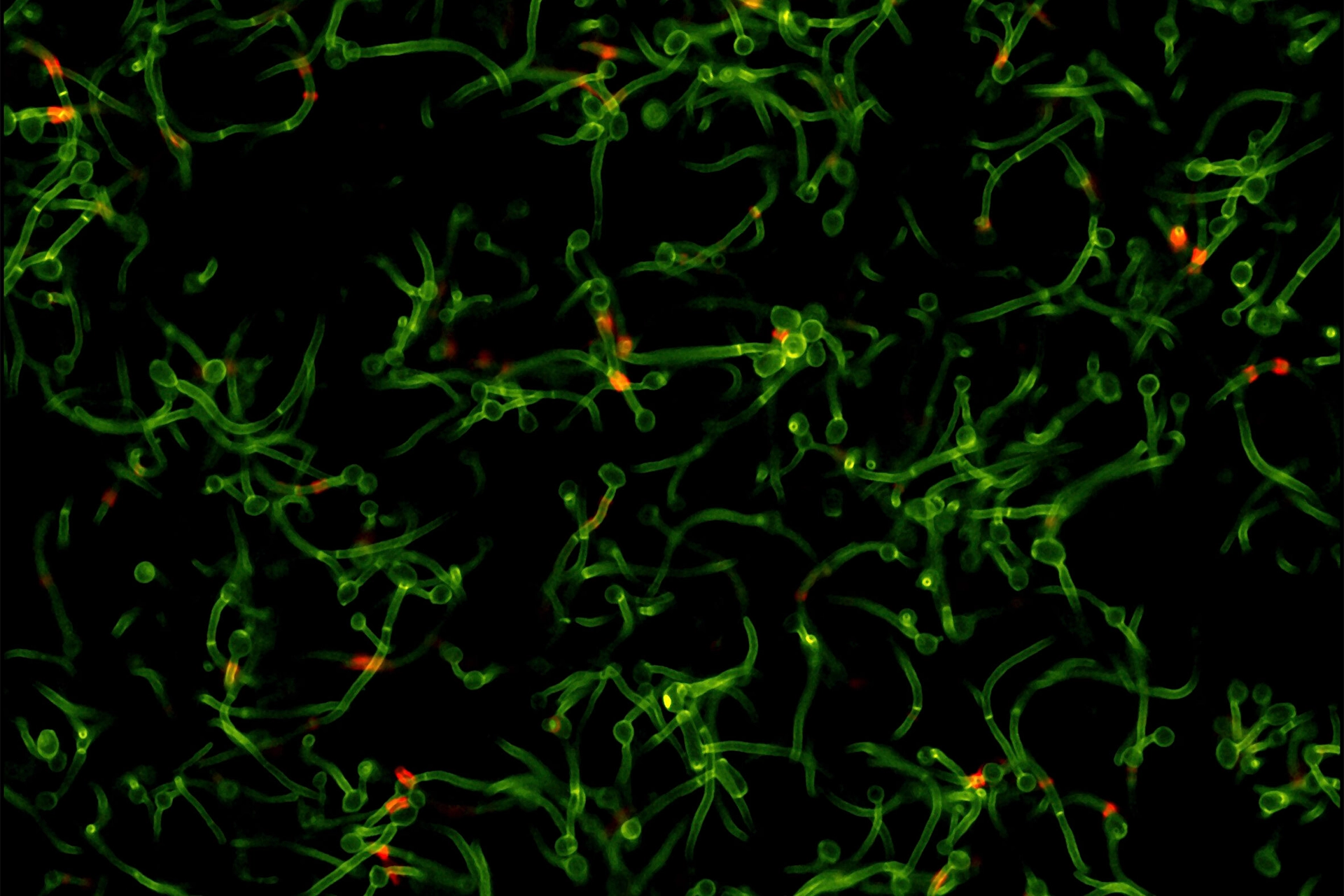 Fluorescent image of scattered cells infected with fungi