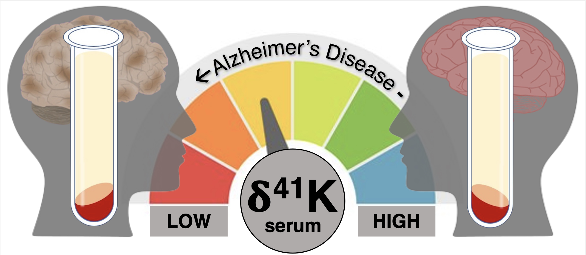 Alzheimers Disease and Potassium Graphic