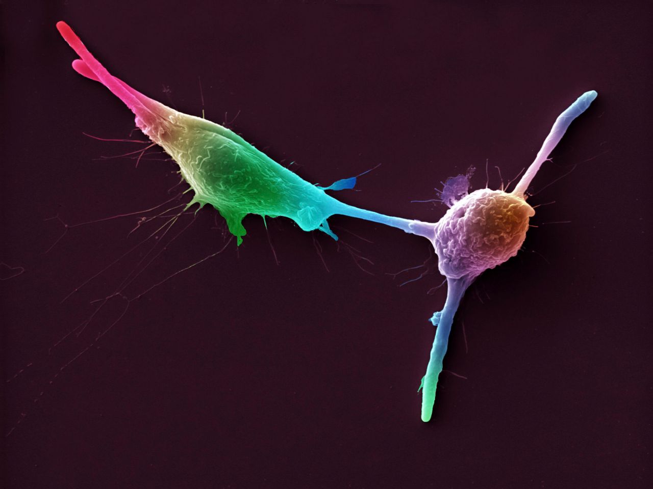 Colourful picture of fungal spore colonising a macrophage