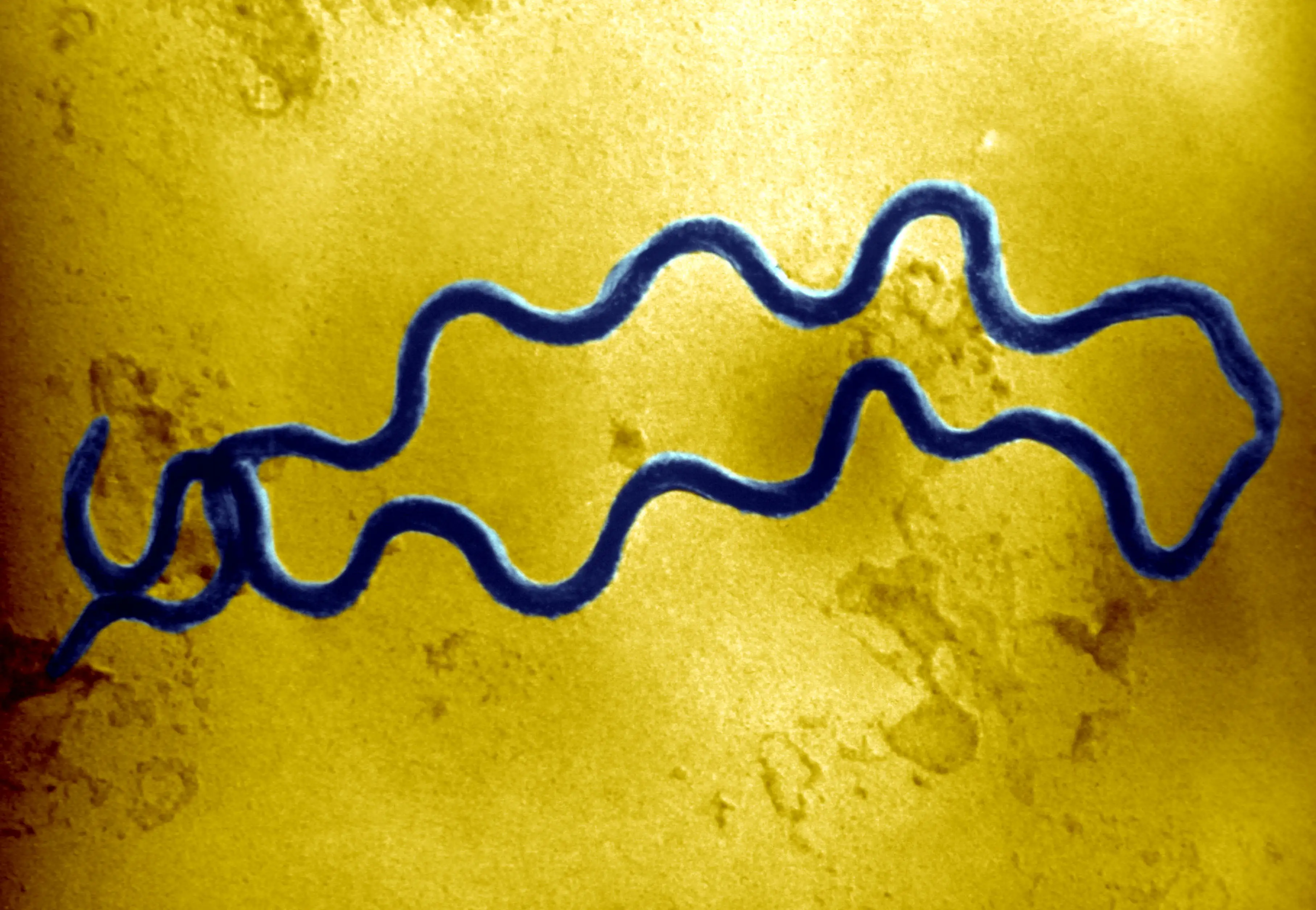 An Electron Photomicrograph Of Two Spiral Shaped Treponema Pallidum Bacteria