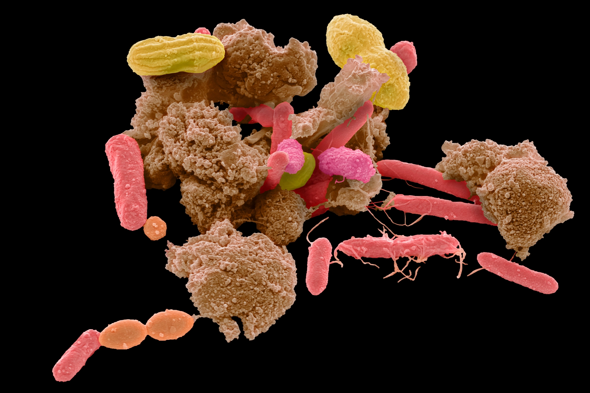 Electron micrograph of various bacterial cells