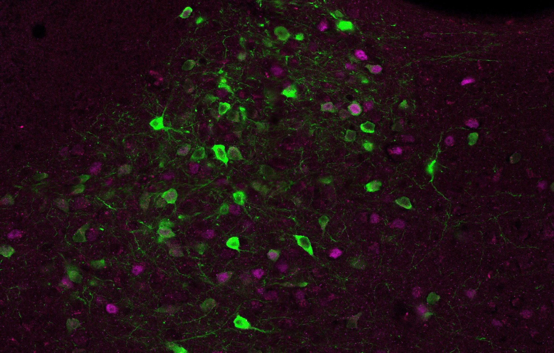 A microscope photo of green and pink neurons on a black background