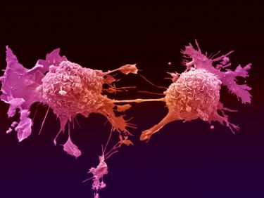 Curbing cancer’s addiction to treat it thumbnail image