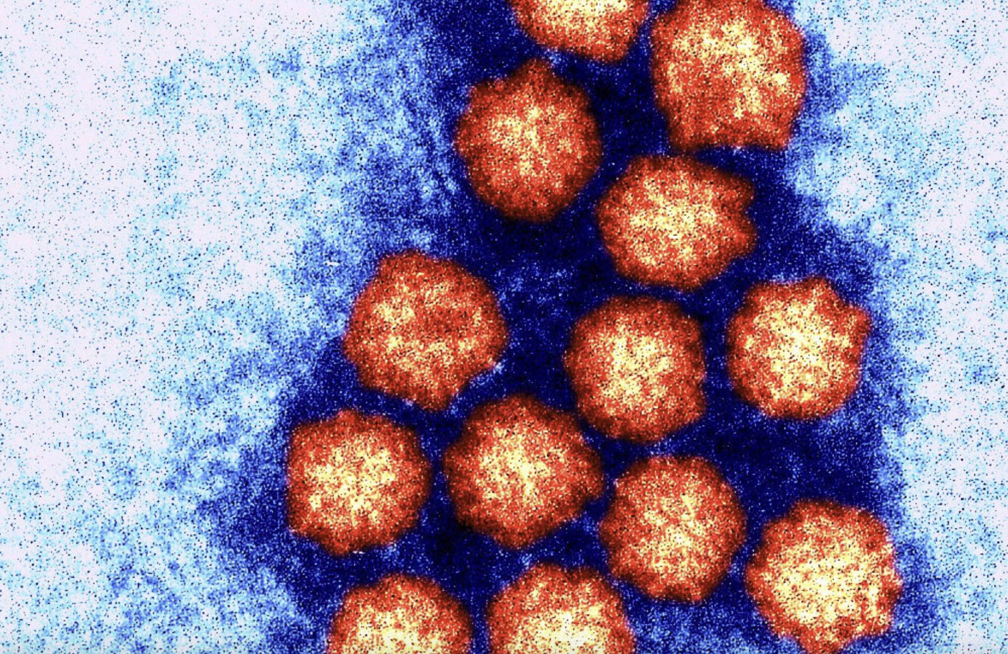 A colour-enhanced close up of norovirus