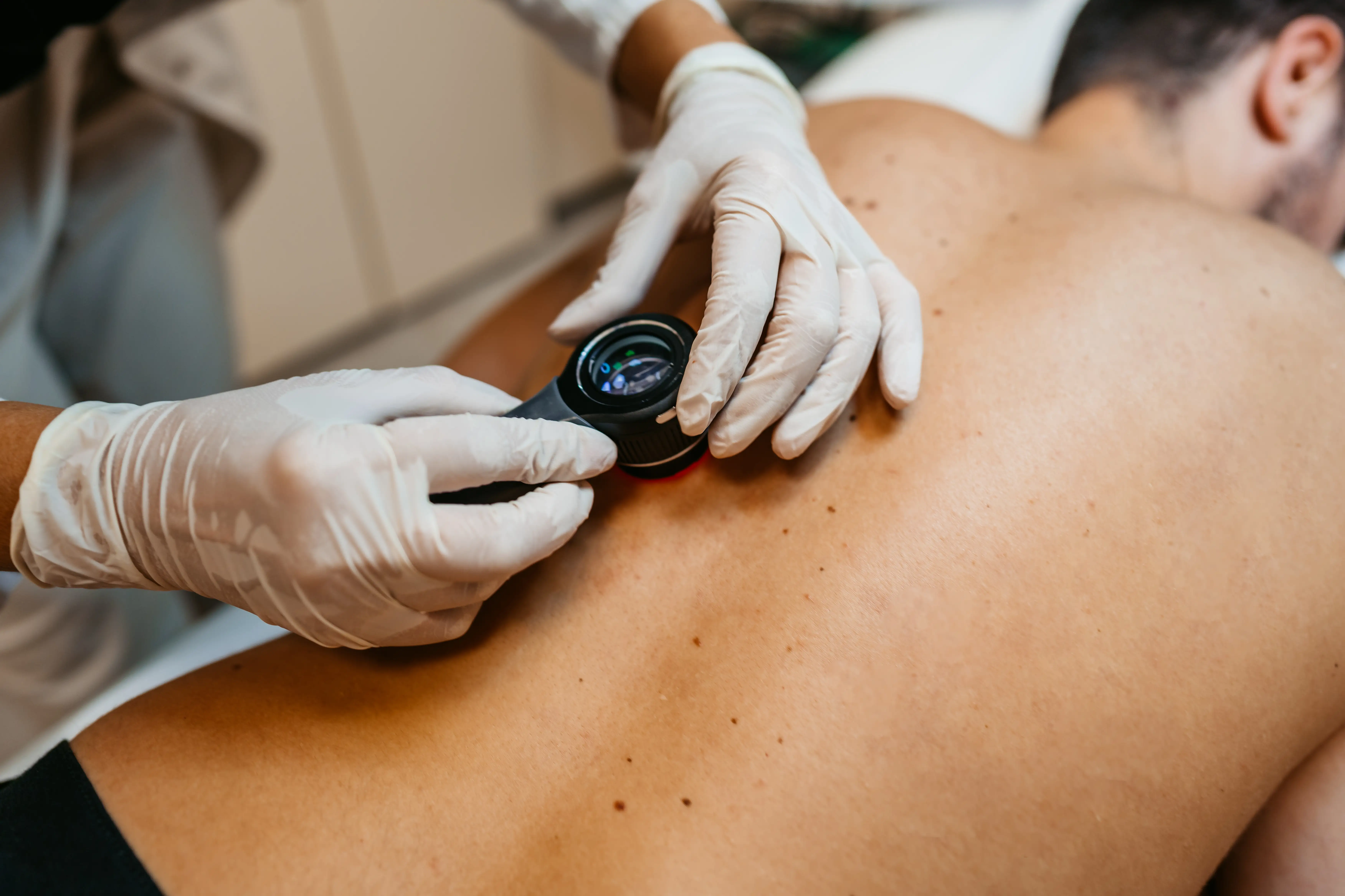 A doctor checks the moles on a man's back