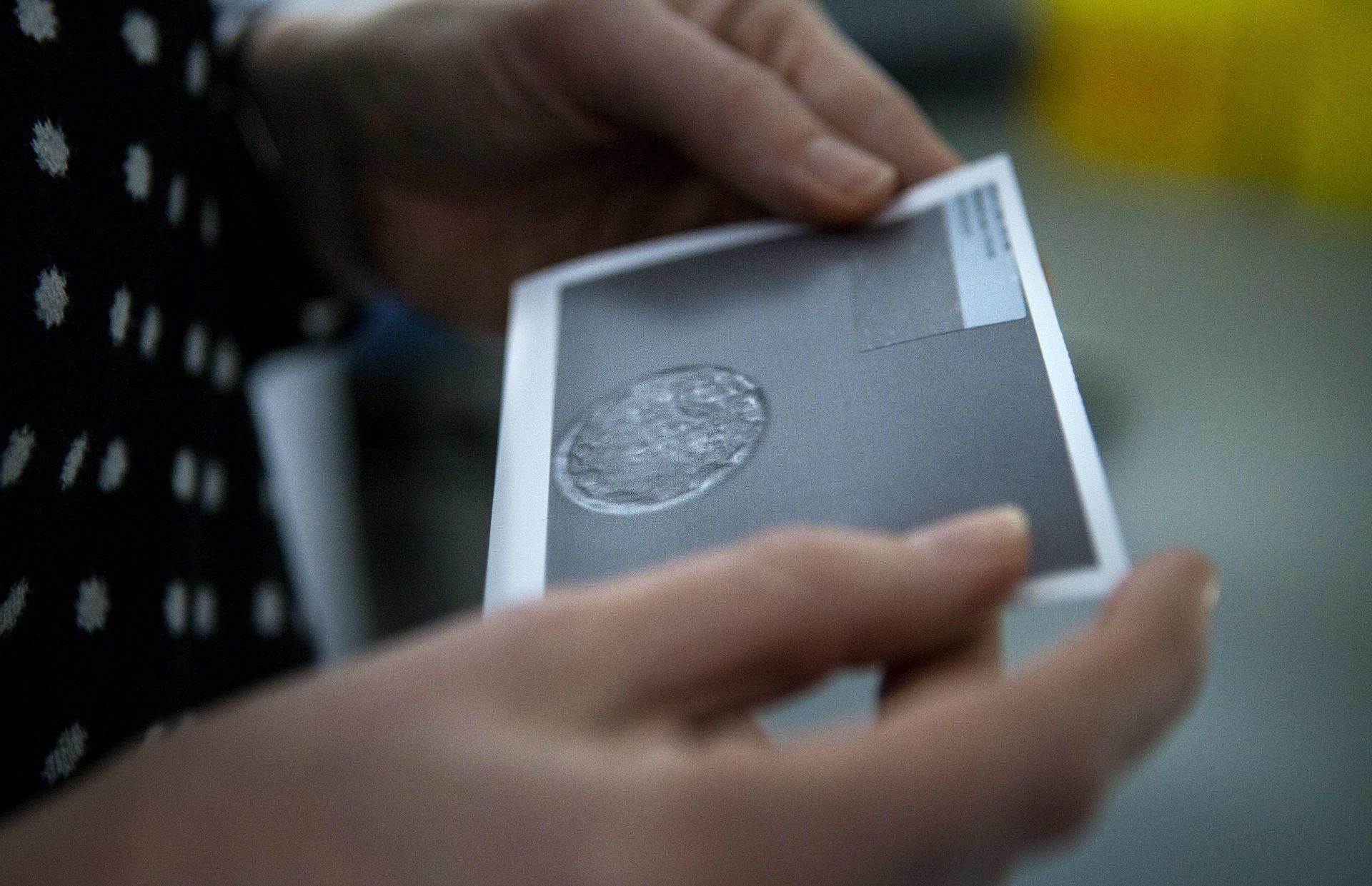 Ultrasound of egg or embryo in hands