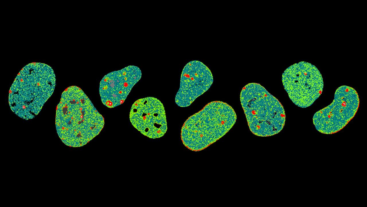 Live cell DNA architecture in real time thumbnail image