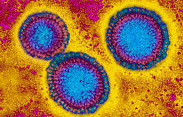 Our ‘killer’ cells’ role in life-long flu vaccine thumbnail image