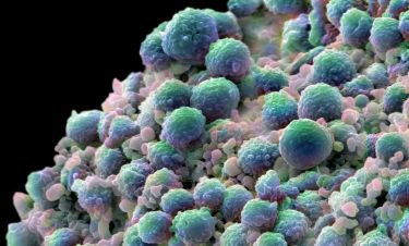 The blood test tracking down microscopic cancer DNA thumbnail image
