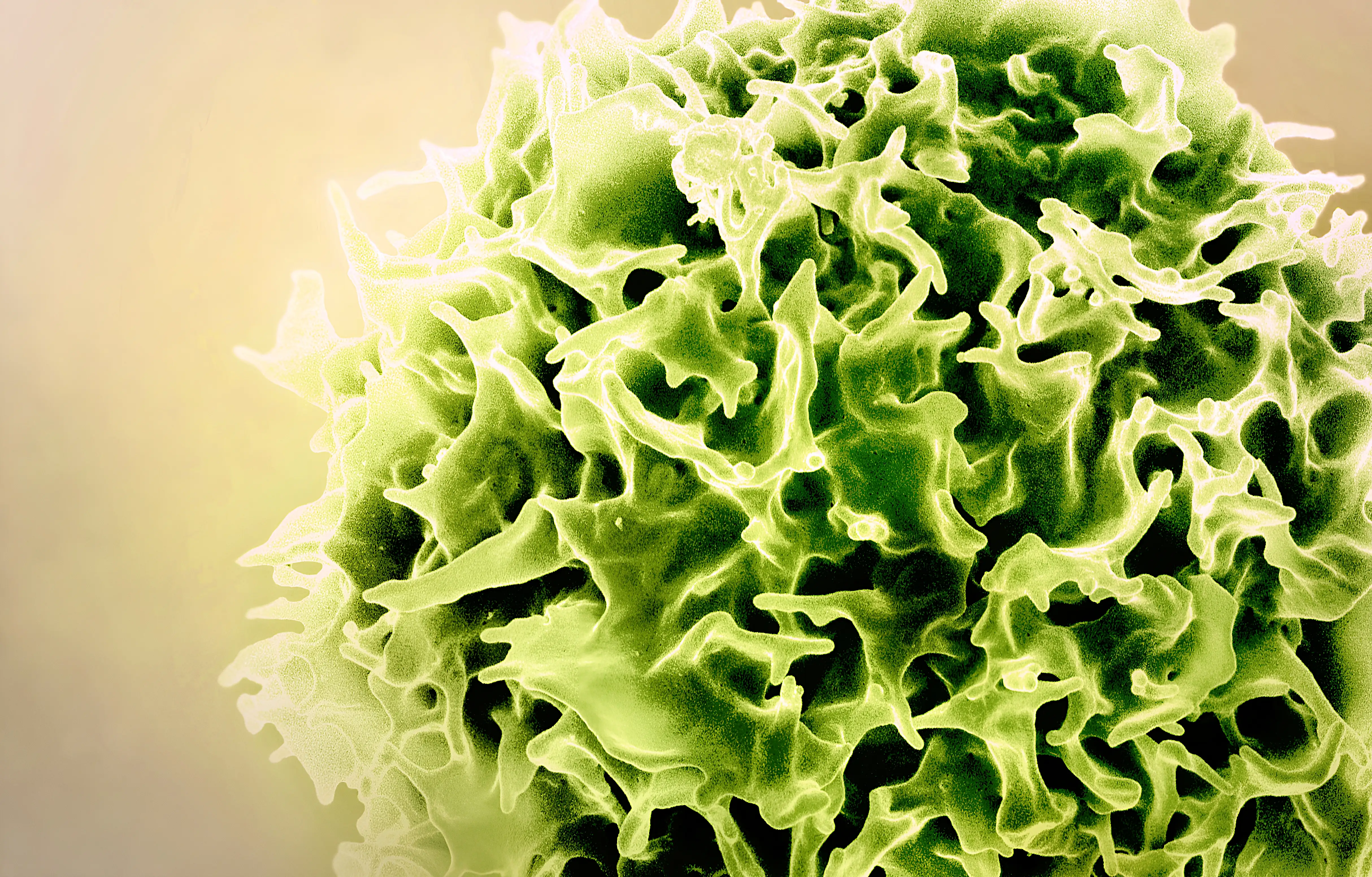 Colorized scanning electron micrograph of a T lymphocyte (also known as a T cell) (green).