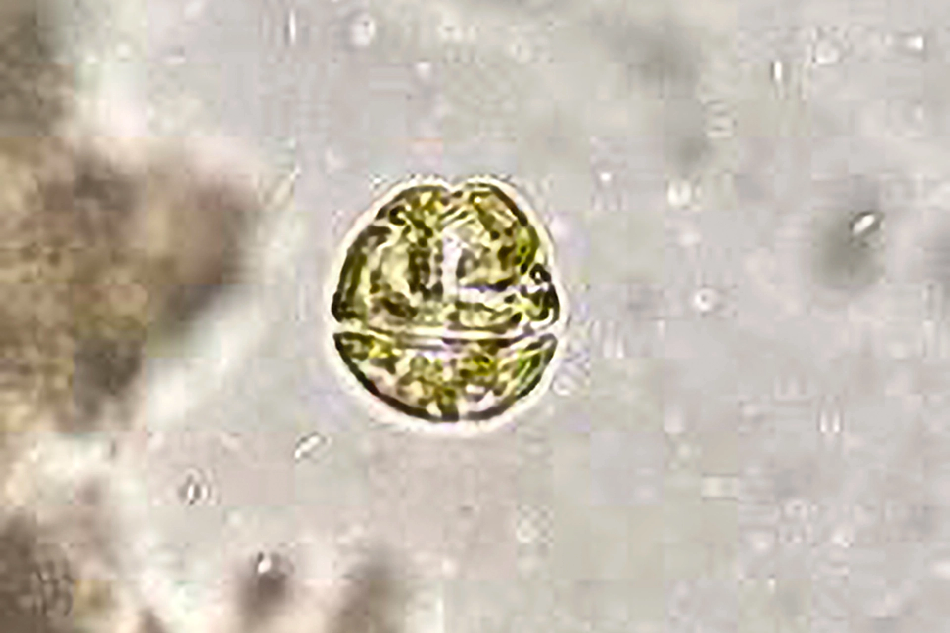 Microscope image of a microalgae cell