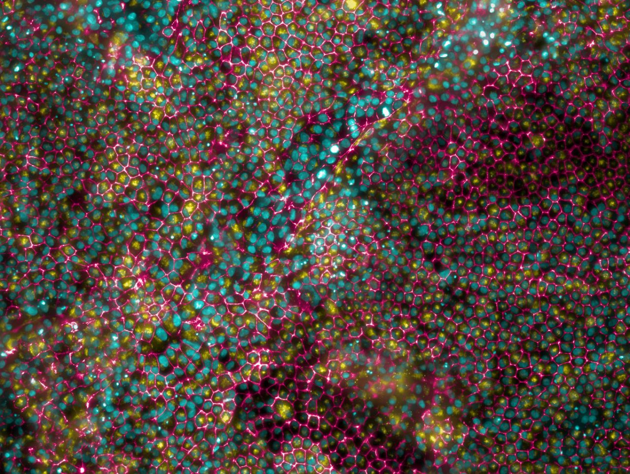New stem cell models for ageing and eye diseases thumbnail image