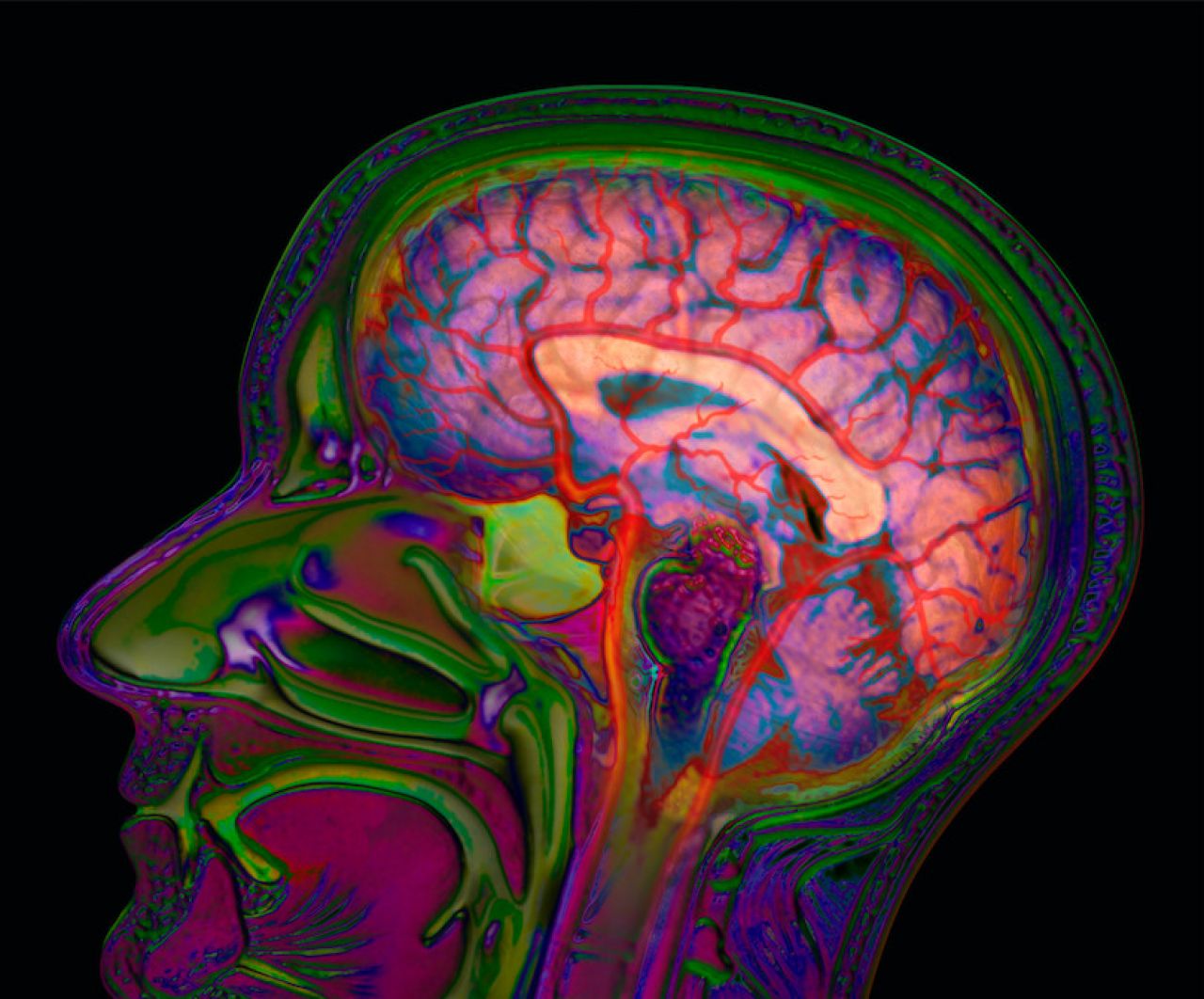 Chemogenetics: A new way to understand brain function thumbnail image