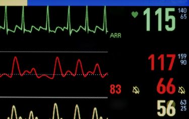 World-first test could predict your risk of a heart attack thumbnail image