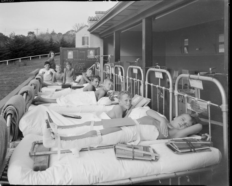 Remembering Australia’s polio scourge | Pursuit by the University of ...