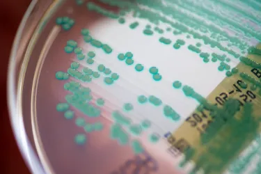 Picture of a petri dish with MRSA bacteria (methicillin-resistant Staphylococcus aureus)