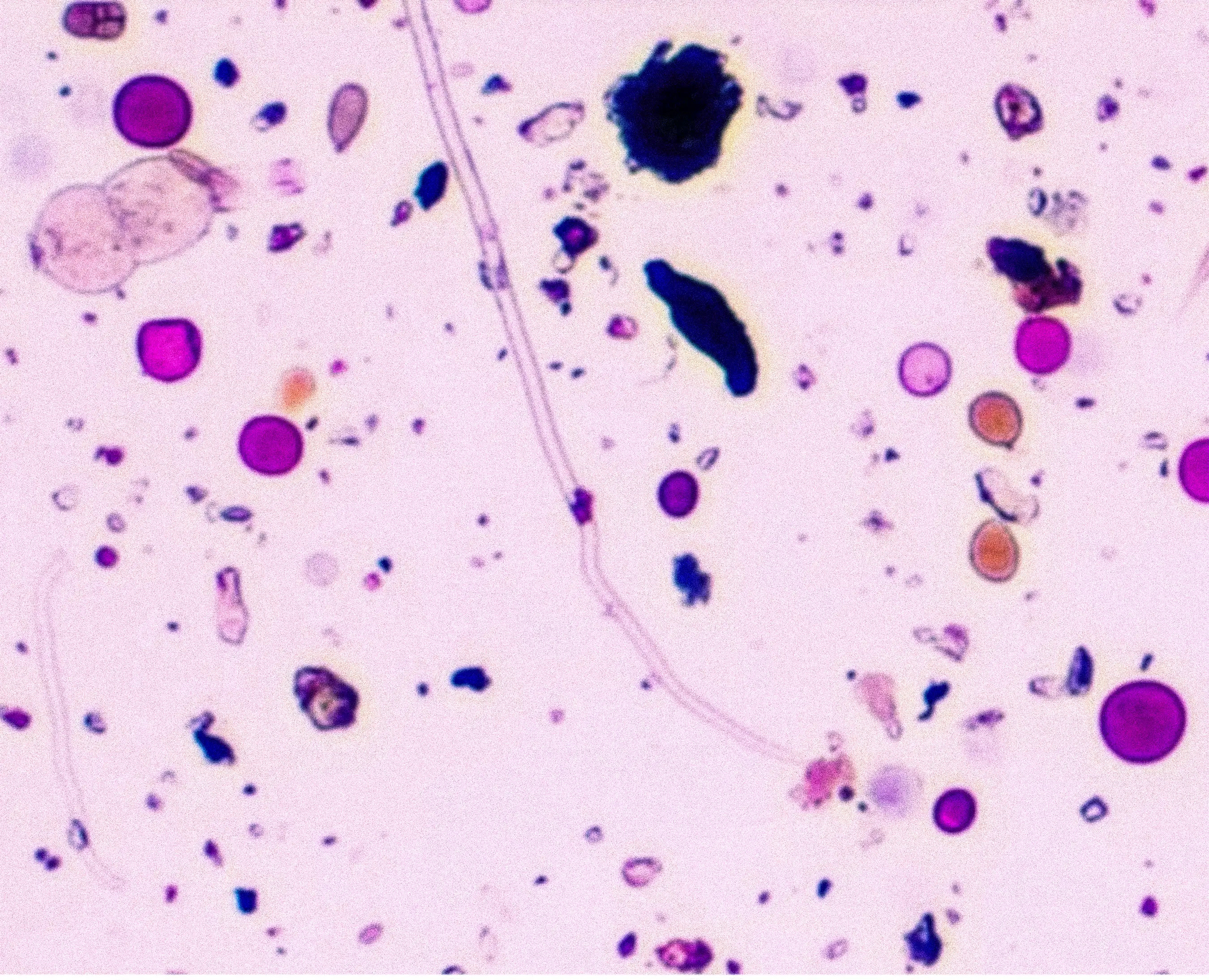 A scientific slide showing a range of pollens in a daily air sample