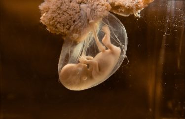 The discovery shedding light on birth defects thumbnail image