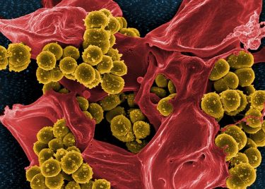 Germ warfare: Young researchers combatting diverse microbe threats thumbnail image