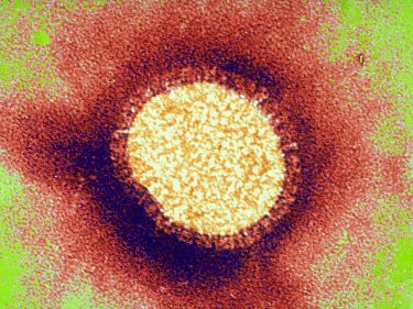 Forecasting flu outbreaks thumbnail image