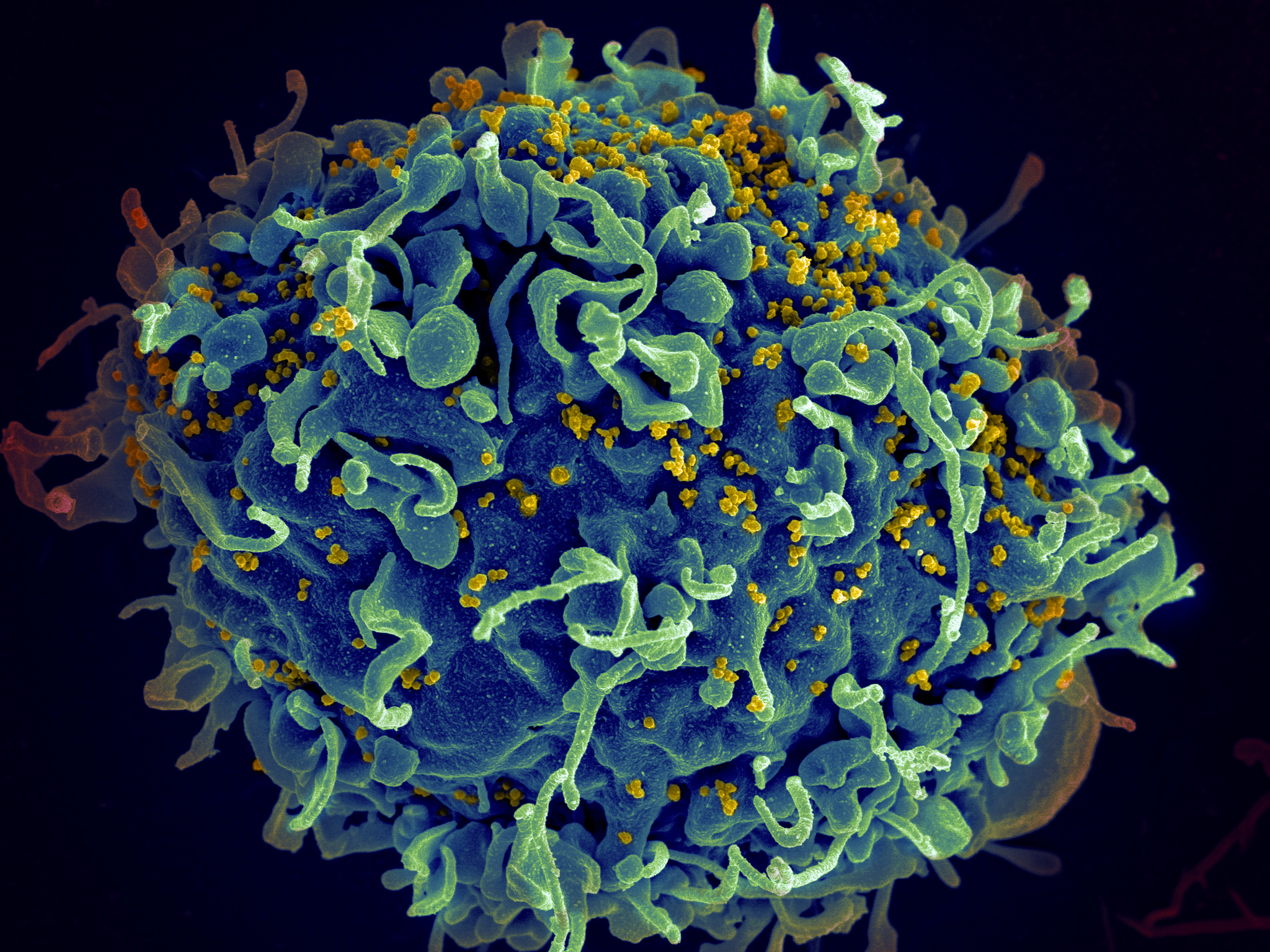 HIV: Probing for a pathway to a cure : Find an Expert : The University ...